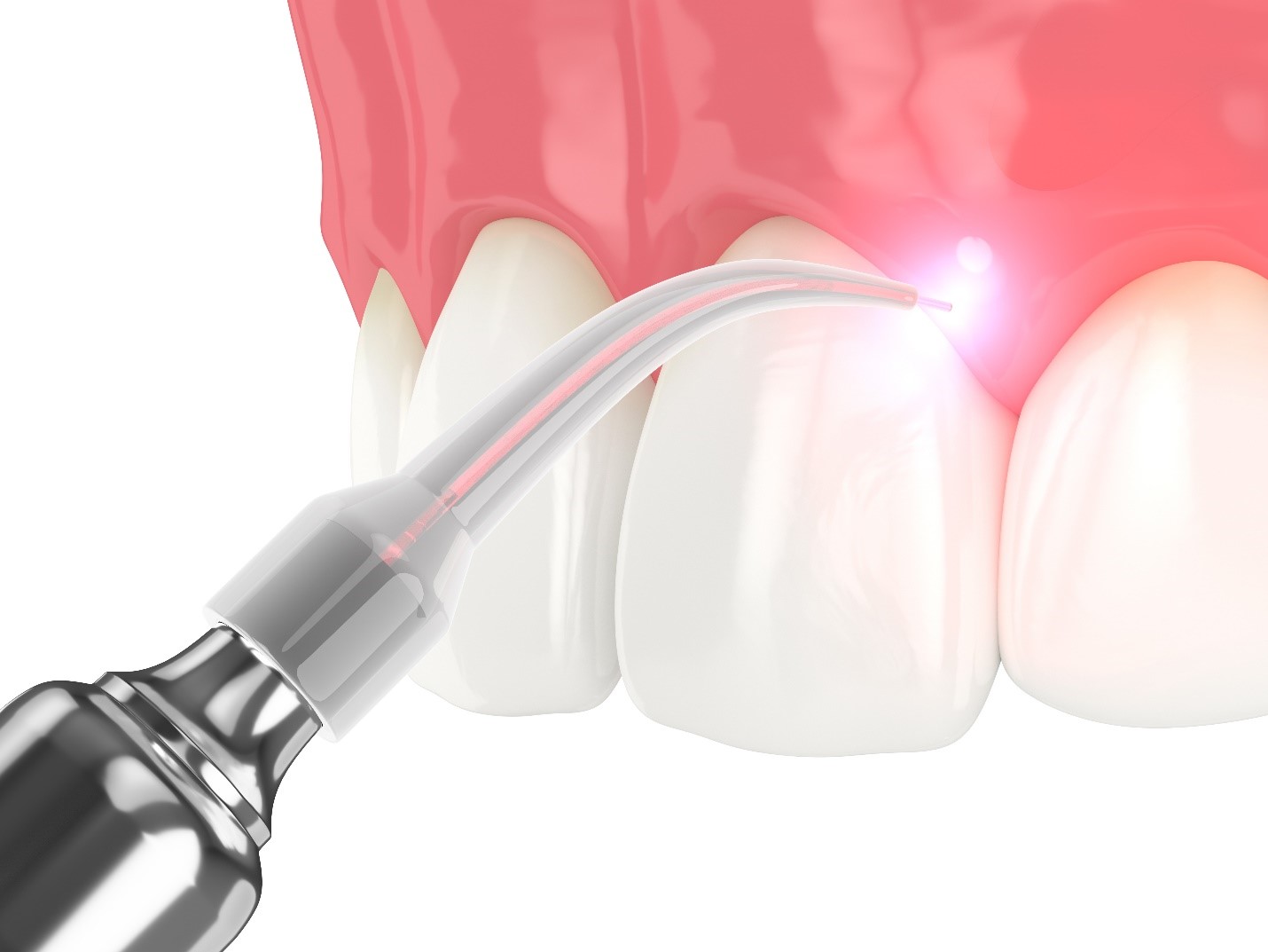 Contemporary Periodontics & Implant Dentistry