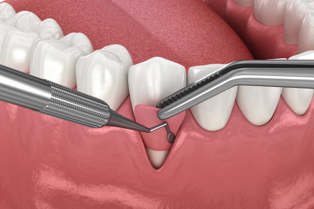 Contemporary Periodontics & Implant Dentistry